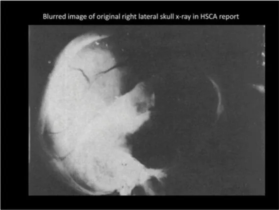 A Review of the JFK Cranial x-Rays and Photographs