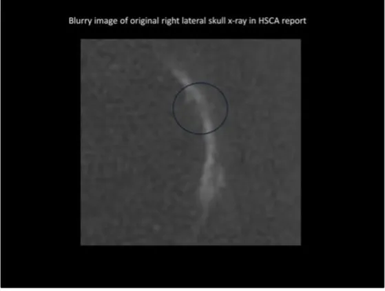 A Review of the JFK Cranial x-Rays and Photographs