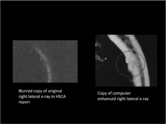 A Review of the JFK Cranial x-Rays and Photographs