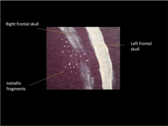 A Review of the JFK Cranial x-Rays and Photographs