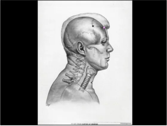 A Review of the JFK Cranial x-Rays and Photographs