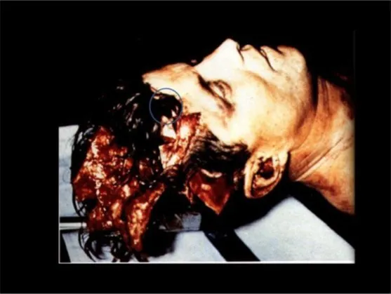 A Review of the JFK Cranial x-Rays and Photographs