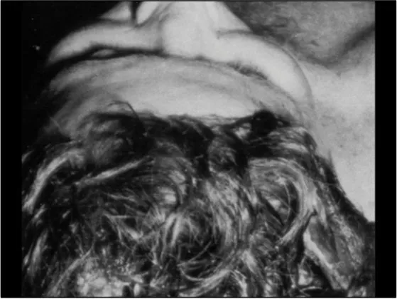 A Review of the JFK Cranial x-Rays and Photographs