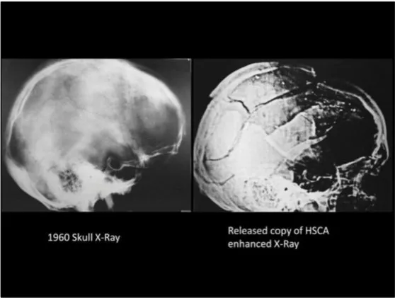 A Review of the JFK Cranial x-Rays and Photographs