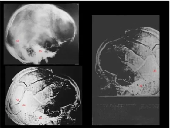 A Review of the JFK Cranial x-Rays and Photographs