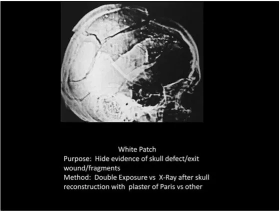 A Review of the JFK Cranial x-Rays and Photographs