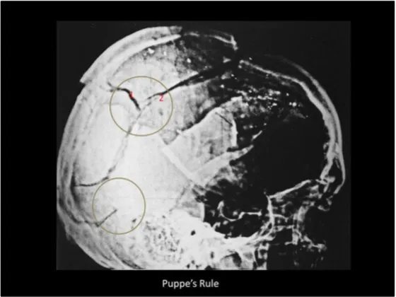 A Review of the JFK Cranial x-Rays and Photographs