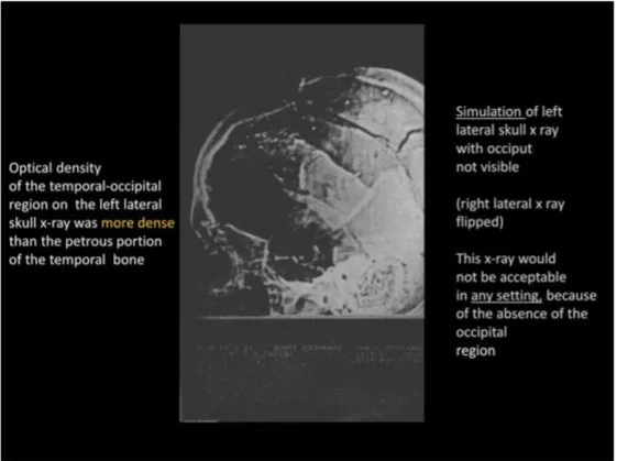 A Review of the JFK Cranial x-Rays and Photographs