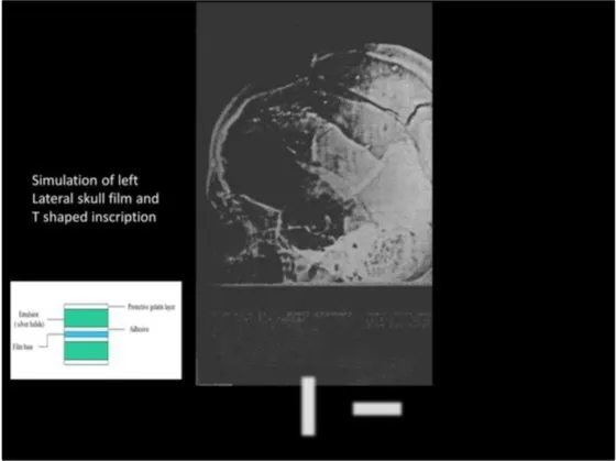 A Review of the JFK Cranial x-Rays and Photographs