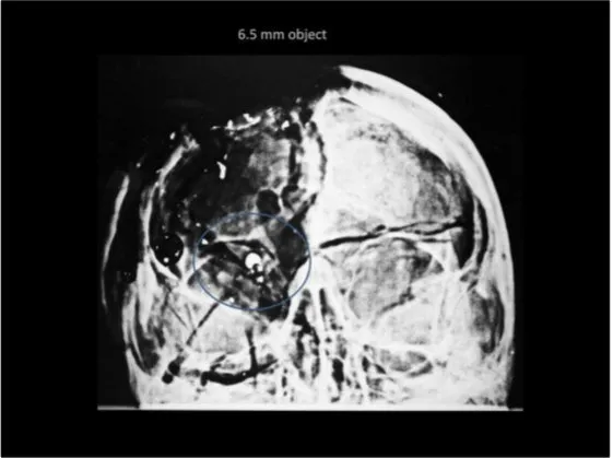 A Review of the JFK Cranial x-Rays and Photographs
