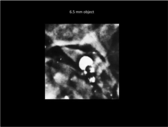 A Review of the JFK Cranial x-Rays and Photographs