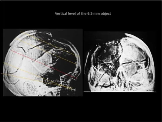 A Review of the JFK Cranial x-Rays and Photographs