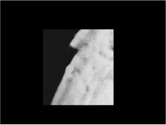 A Review of the JFK Cranial x-Rays and Photographs
