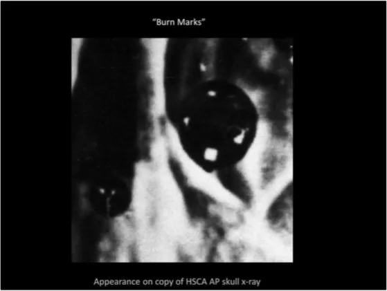 A Review of the JFK Cranial x-Rays and Photographs