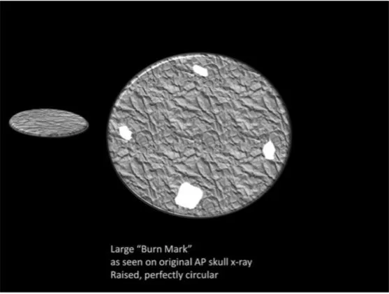 A Review of the JFK Cranial x-Rays and Photographs