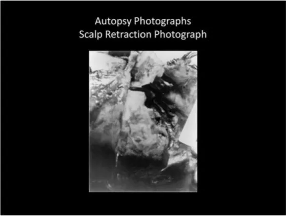 A Review of the JFK Cranial x-Rays and Photographs 