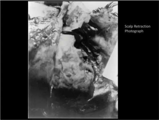 A Review of the JFK Cranial x-Rays and Photographs 