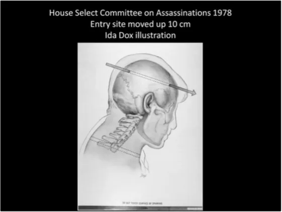 A Review of the JFK Cranial x-Rays and Photographs