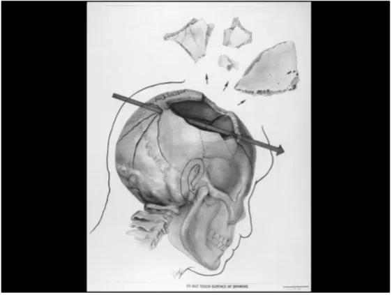 A Review of the JFK Cranial x-Rays and Photographs