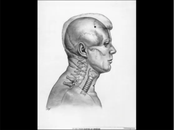 A Review of the JFK Cranial x-Rays and Photographs