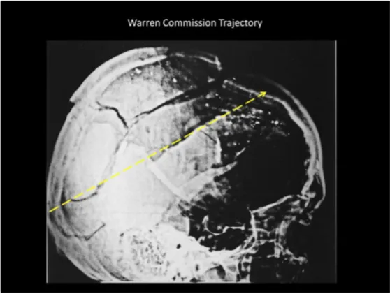 A Review of the JFK Cranial x-Rays and Photographs