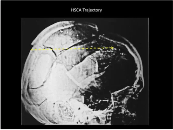 A Review of the JFK Cranial x-Rays and Photographs