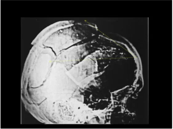 A Review of the JFK Cranial x-Rays and Photographs