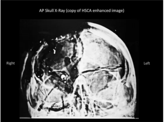 A Review of the JFK Cranial x-Rays and Photographs