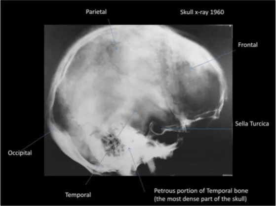 A Review of the JFK Cranial x-Rays and Photographs