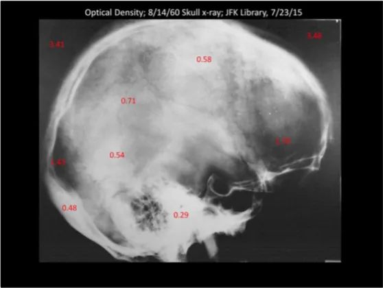 A Review of the JFK Cranial x-Rays and Photographs
