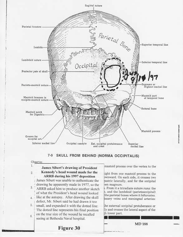 James Sibert Description